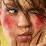 Трихотилломания: Понимание и Преодоление Невольного Тяги к Выдергиванию Волос