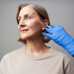 Игольчатый РФ-лифтинг: Преображение Вашей Кожи