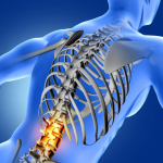 Лечение позвоночника: как вернуть спине здоровье и комфорт