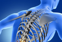 Лечение позвоночника: как вернуть спине здоровье и комфорт